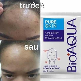 Mask trị mụn bioaqua nội địa trung