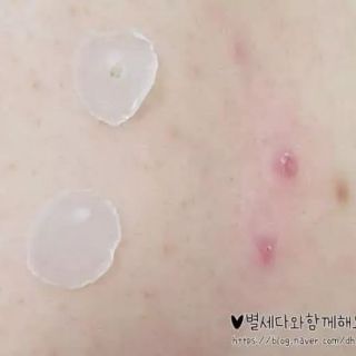 Miếng dán mụn Cosrx