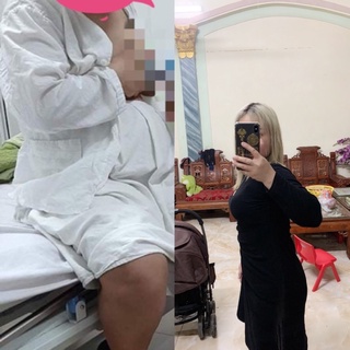 ( CHÍNH HÃNG) Ảnh Thật siêu giảm cân CỐT BÍ ĐAO