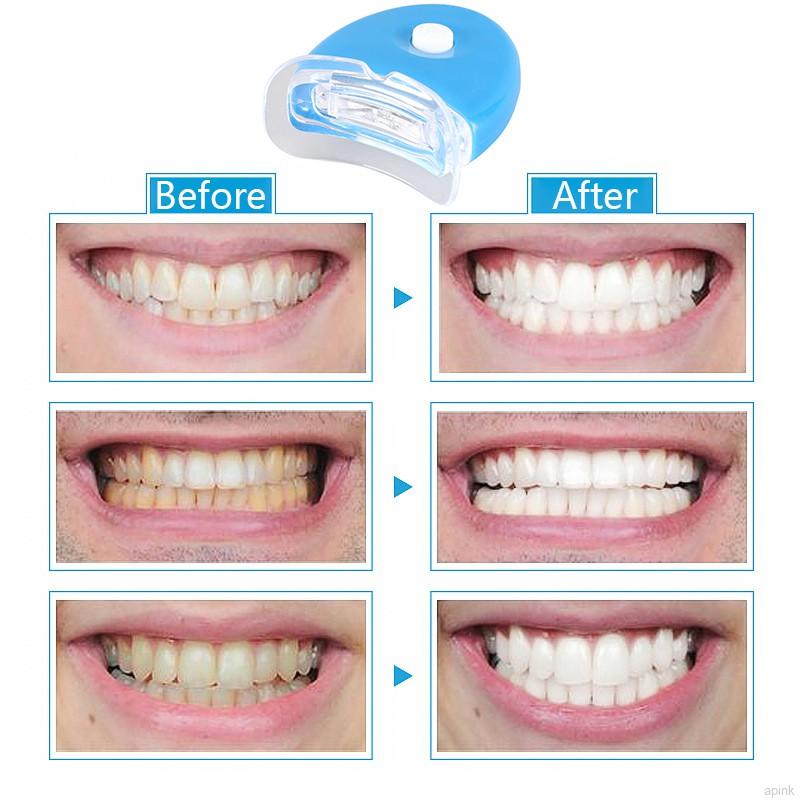 [Hàng mới về] Bộ sản phẩm hỗ trợ làm trắng răng chất lượng cao
