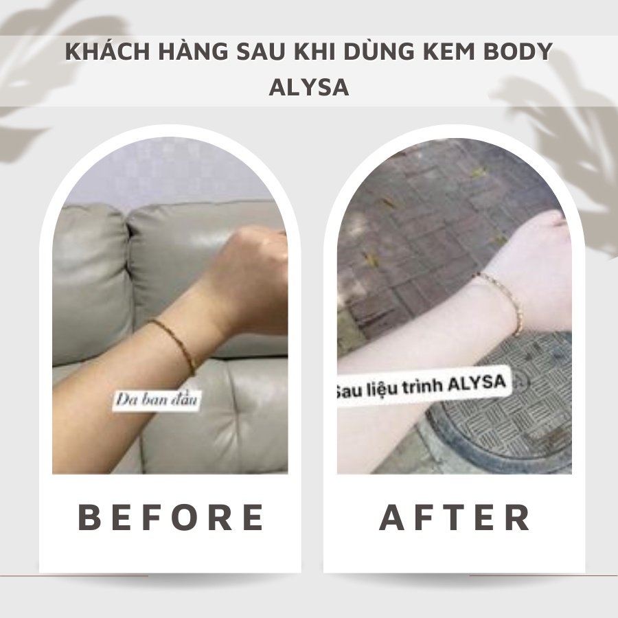 Kem body trắng da toàn thân cao cấp ALYSA ngày và đêm, bật tone sau 7- 10 ngày, kem dưỡng trắng da siêu thấm, mềm mịn | BigBuy360 - bigbuy360.vn