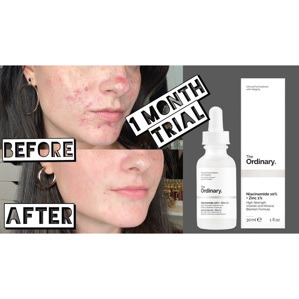 Serum The Ordinary Niacinamide 10% + Zinc 1%