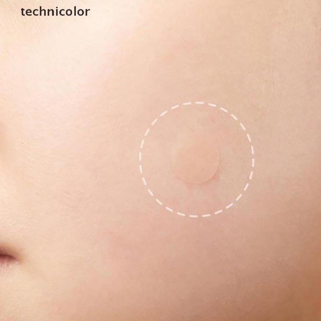 [Hàng mới về] Set 36 miếng dán mụn trứng cá Hydrocolloid