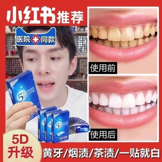 [Hàng mới về] Miếng dán làm trắng răng tiện lợi