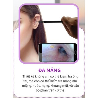 Dụng Cụ Lấy Ráy Tai có Camera Mini quan sát - King's Garden