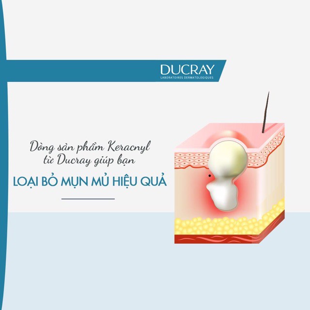 [TEM CTY] Ducray Keracnyl PP Anti Blemish Soothing Cream 30 mL - Kem Dưỡng Da, Ngăn Ngừa Mụn, Giảm Vết Thâm.