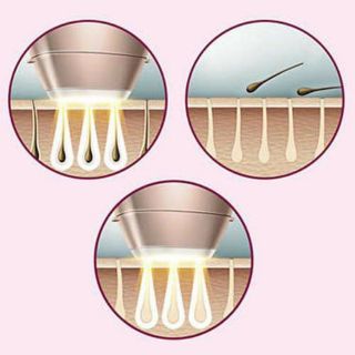 Máy triệt lông Philips BRI921/00 Lumea IPL