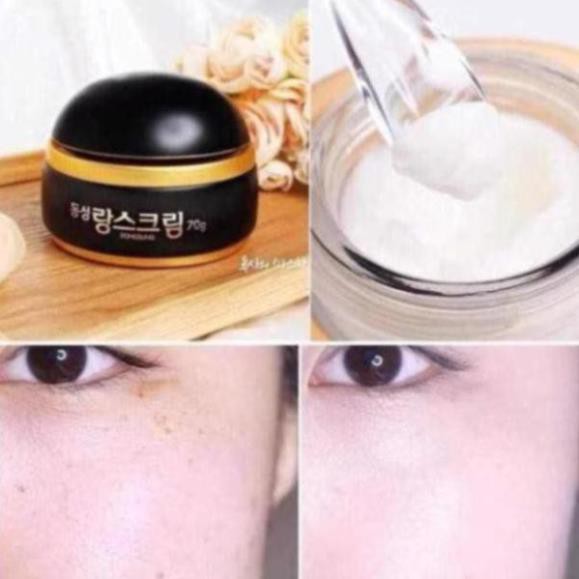 Kem Ngừa Nám  DONGSUNG RANNCE CREAM Hàn Quốc | WebRaoVat - webraovat.net.vn