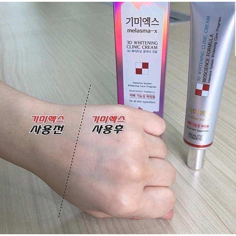 kem nám 3D Melasma | BigBuy360 - bigbuy360.vn