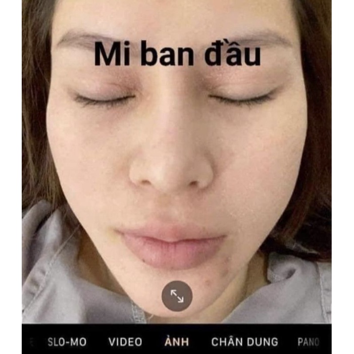 KÍCH MỌC VÀ DÀI MI