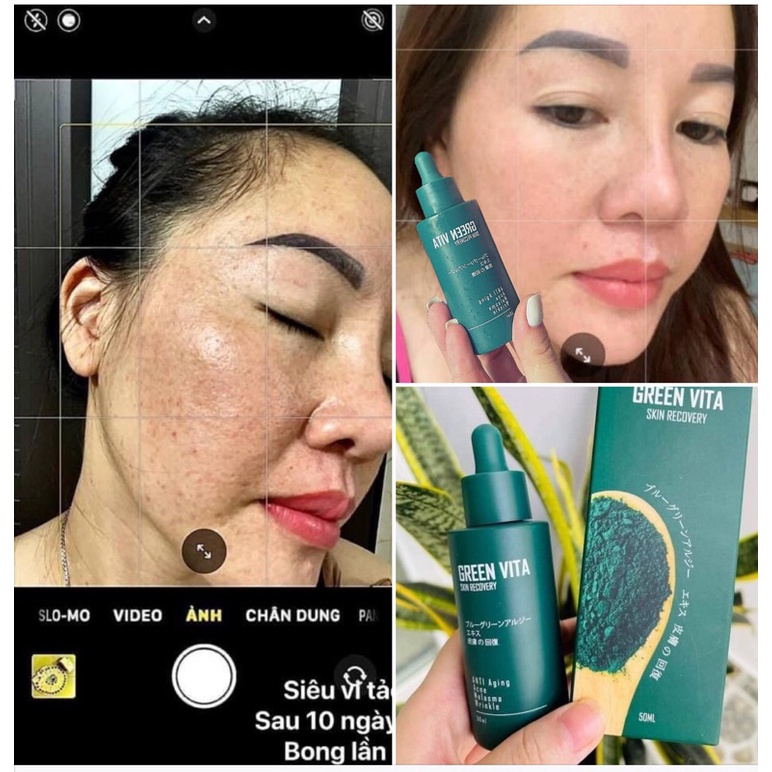 SERUM VI TẢO GREEN VITA CHÍNH HÃNG