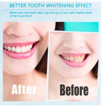 Máy làm trắng răng SMILEKIT - Máy làm trắng răng không ê buốt, giúp răng trắng sáng, chắc khỏe từ trong-Bảo hành 6 tháng