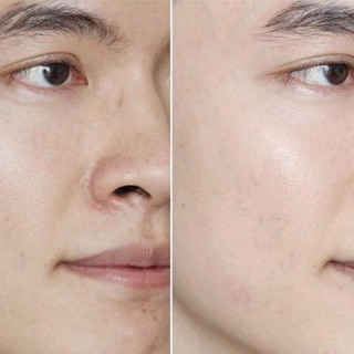 SERUM VITAMIN C BALANCE