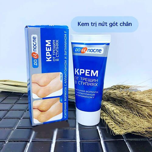 Kem trị nứt gót chân Nga