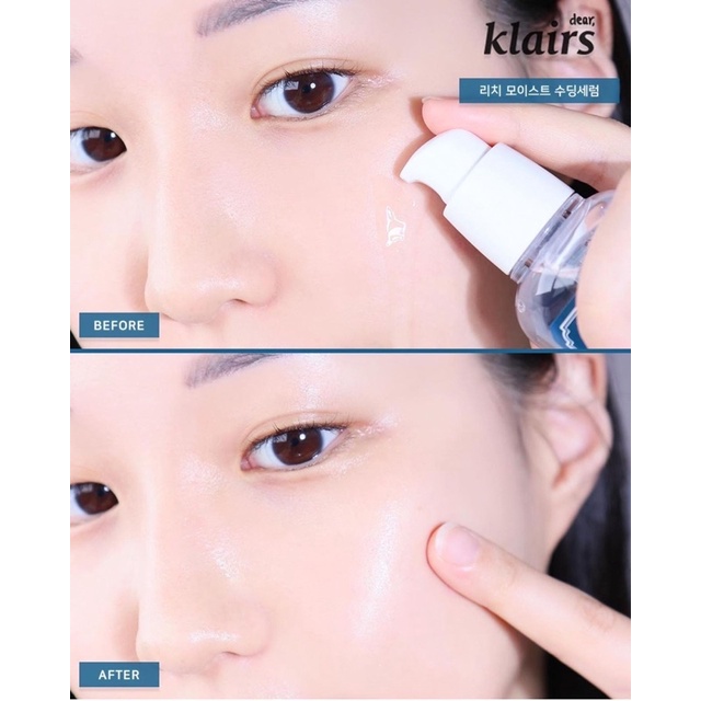 Dưỡng Da Klairs Rich Moist Soothing Serum / Cream