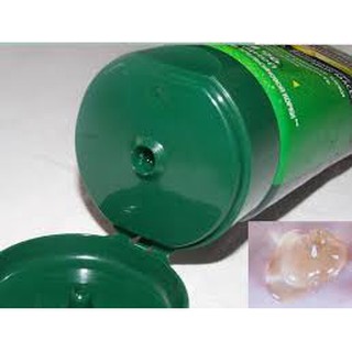 GEL TRỊ RẠN DA VÀ GIẢM MỠ PURELINE