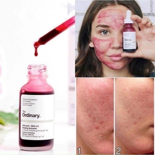 Tinh chất The Ordinary AHA 30% + BHA 2% Peeling Solution ( 30mL)