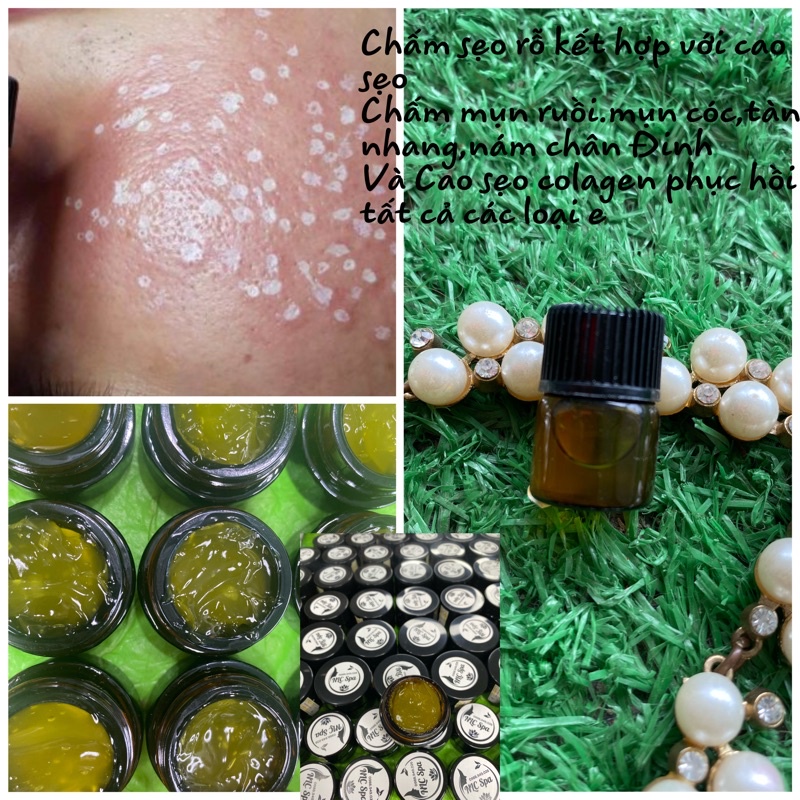 Chấm mụn ruồi ,mụn thịt ,mụn cóc ,seo ỗ kết hợp với cao sẹo