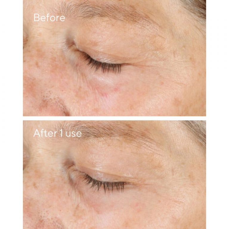 Tẩy tế bào chết đa tầng MURAD Vita-C Triple Exfoliating Facial 10ml đẩy lùi tàn nhang, bổ xung vitamin C