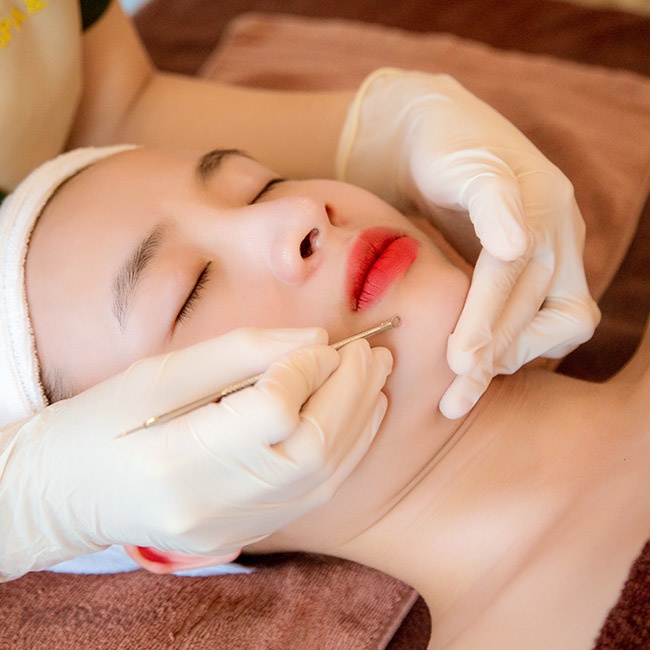 Hà Nội [E-Voucher] May Spa - Điều Trị Mụn Chuyên Sâu, Hiệu Quả Tức Thì (H)