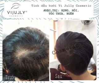 Tinh dầu bưởi VI JULLY ( chính hãng 1000%)