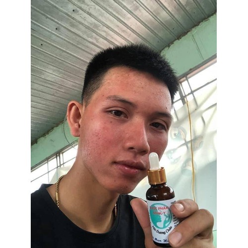 Serum tái tạo bong da sạch mụn nhờn Mộc Dương Châu 30ml