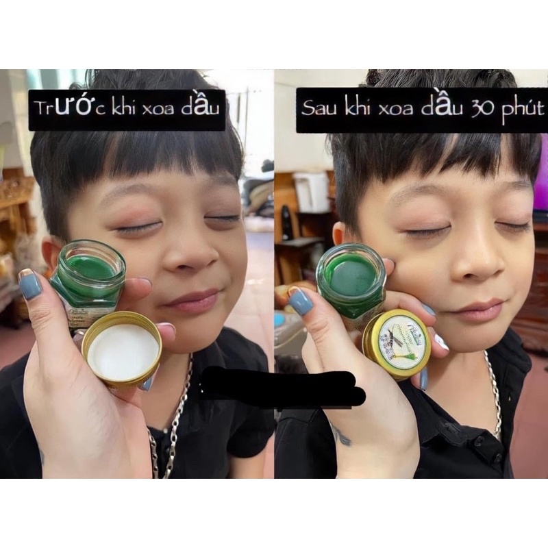 Cao bôi Thươc bôi muỗi đốt côn trùng cắn Thái Lan (Hàng xt trực tiếp) - CÓ SẴN