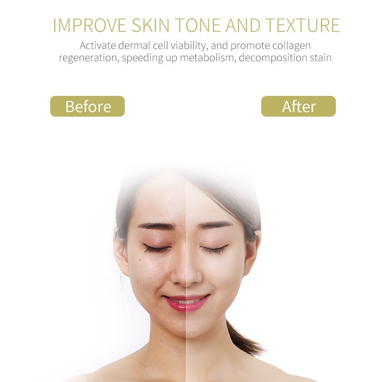 Máy Massage, Rửa Mặt I-On Âm, Đi Điện Nóng Lạnh Đẩy Tinh Chất Có Chân Đế Đi Kèm