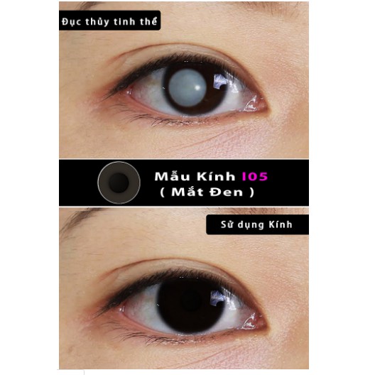 Kính áp tròng thẩm mỹ Qeye, lens che tật thị (che khuyết điểm) xuất xứ Hàn Quốc