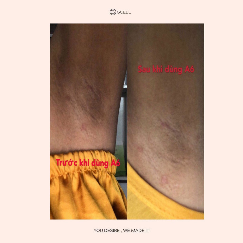 KEM LÀM TRẮNG NÁCH BẸN MÔNG GCELL XXVIRGIN A6