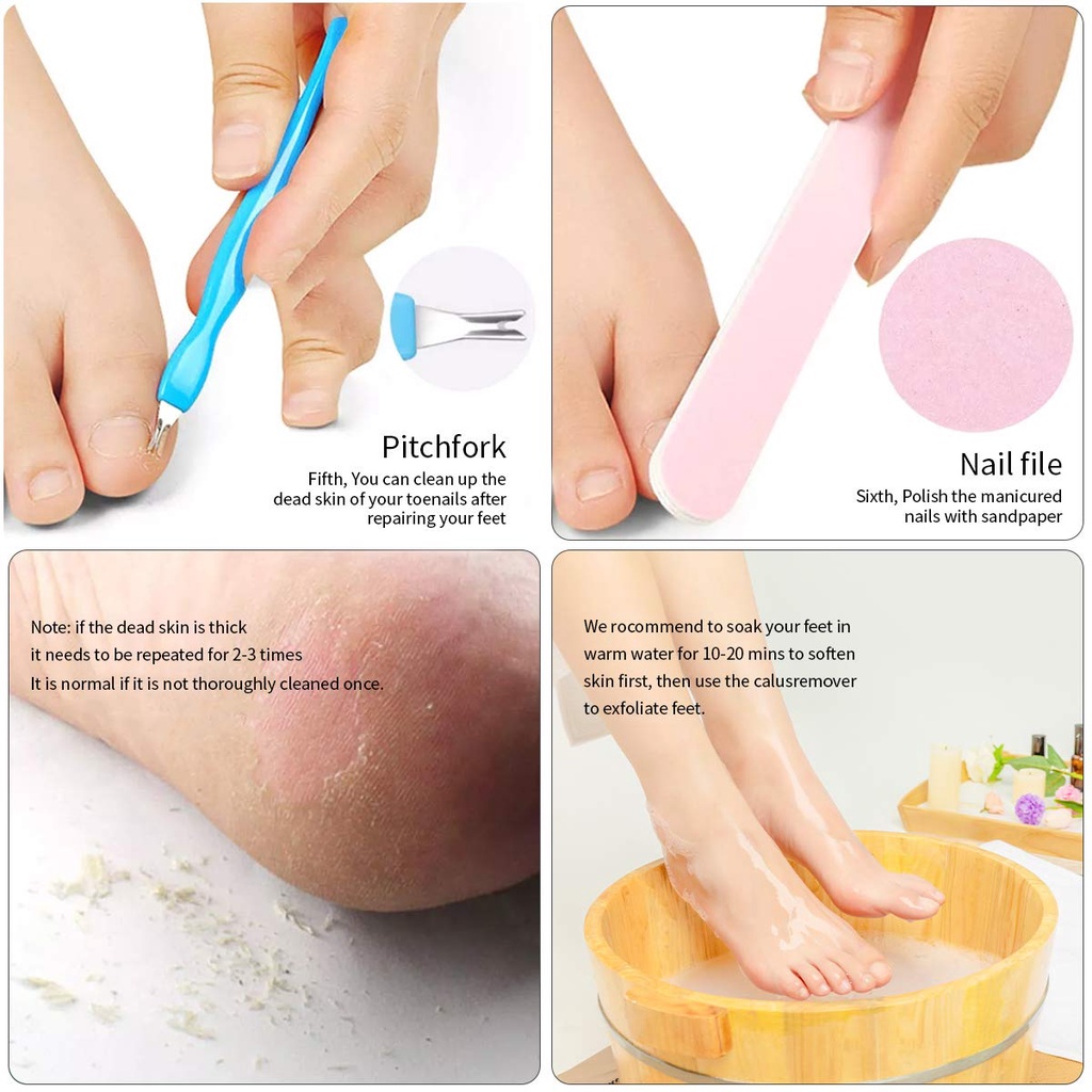 Bộ 8 Dụng Cụ Tẩy Tế Bào Chết Cho Chân Chuyên Nghiệp Bằng Thép Không Gỉ