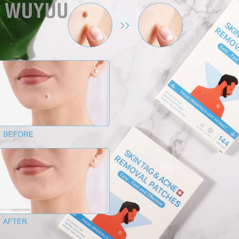 Wuyuu 4pcs Skin Tag Remover Patches Ultra‑Thin Acne Stickers