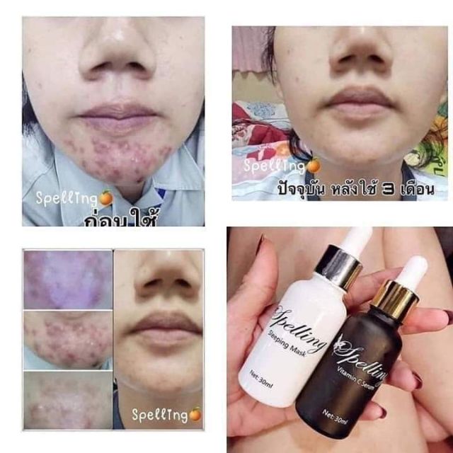 Cặp đôi serum& mat nạ sleeping mask thái lan