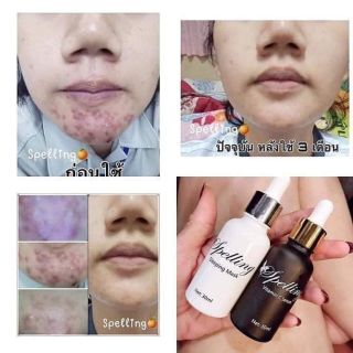Cặp đôi serum& mat nạ sleeping mask thái lan