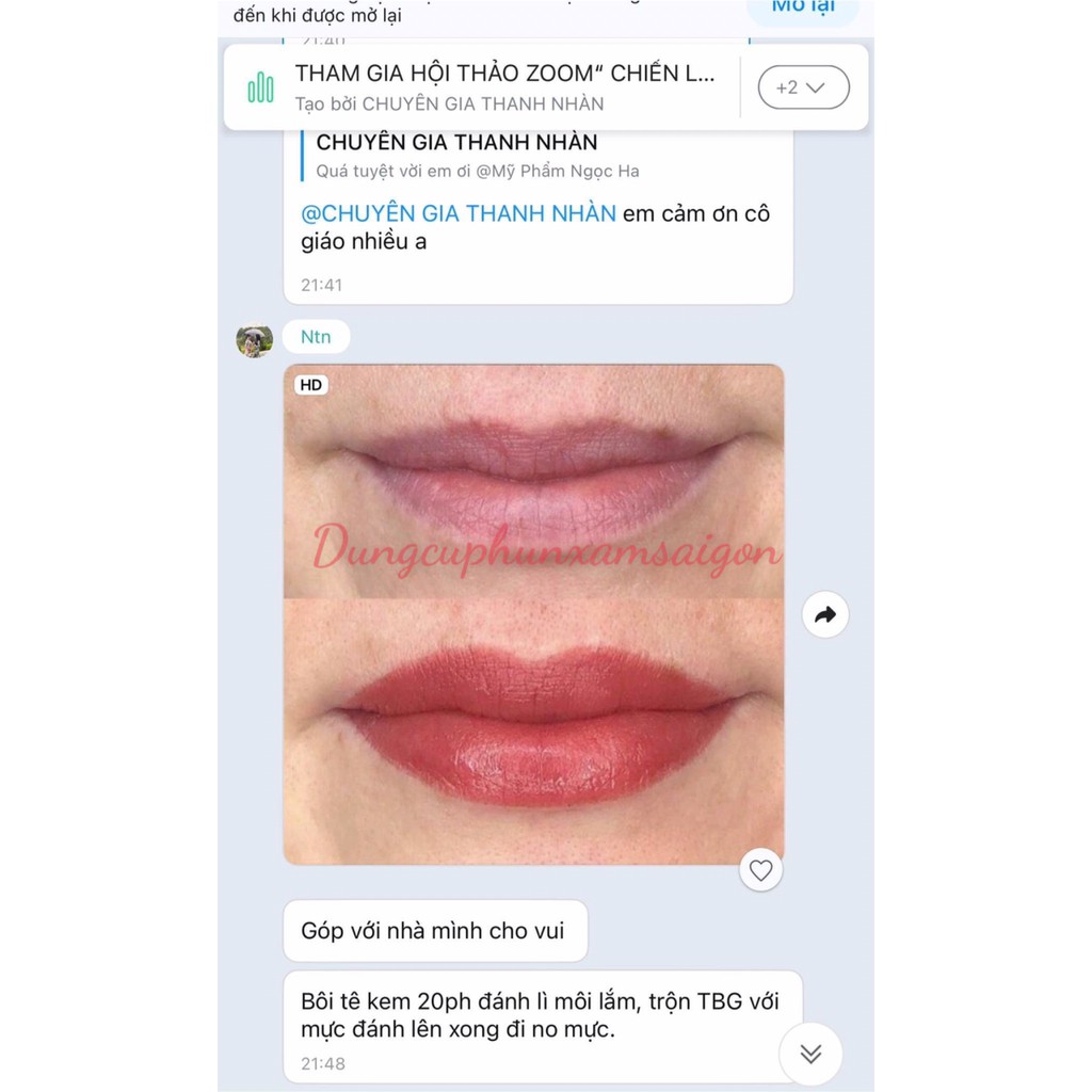 Tinh Chất Dưỡng Môi Tế Bào Gốc Pháp Serum Dưỡng Môi Stem Cell - Dungcuphunxamsaigon