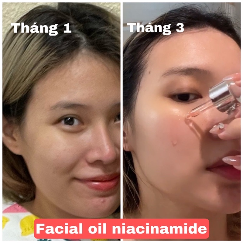 FACIAL OIL NIACINAMIDE