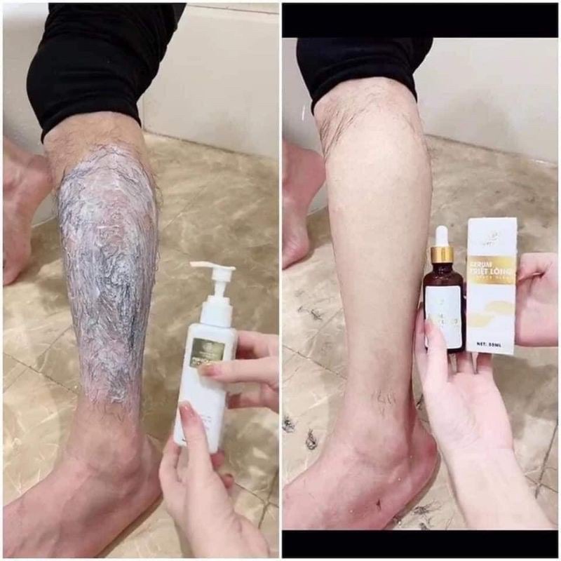 Kem Tẩy Lông Huyền Phi Chính Hãng tặng Serum Triệt Lông Vĩnh Viễn tại nhà An Toàn Hiệu Quả