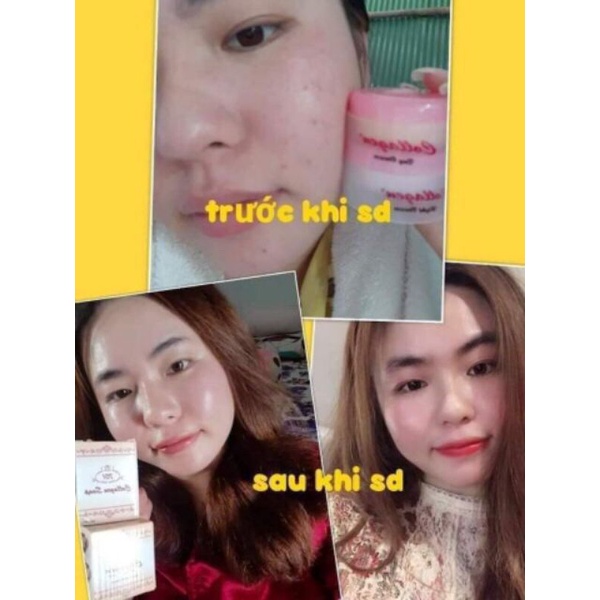 Bộ kem nám tàn nhang collagen plus vit E CHÍNH HÃNG