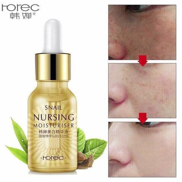 Serum ốc sên chống lão hóa da