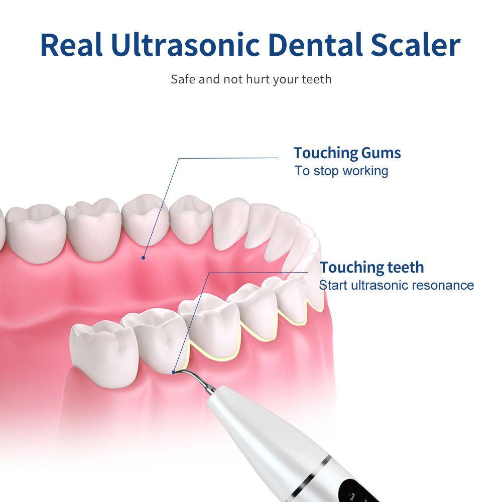 Máy Chăm Sóc Răng Bằng Điện Làm Sạch Và Trắng Răng