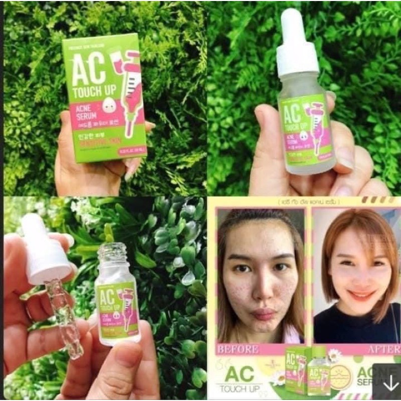 Serum Giảm Thâm Mụn AC Touch Up Acne 10ml