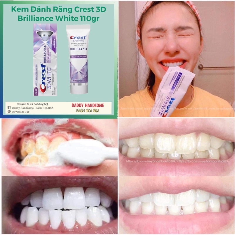 ( Date 2023 ) Kem đánh răng Crest 3D white Brilliance 116 gram