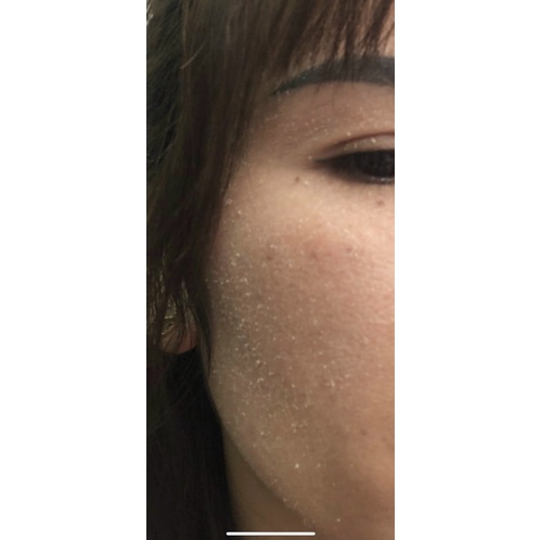 Serum tái tạo đặc PHIÊN BẢN MỚI dùng da MỤN-THÂM_NÁM_TÀN NHANG HANDMADE