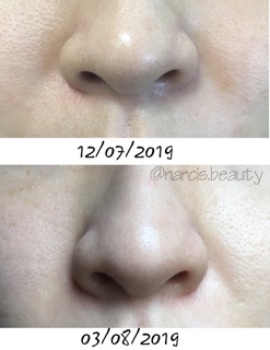 Nước cân bằng PIXI glow tonic