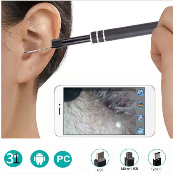 [ Bảo hành 12 tháng ] Máy lấy ráy tai  cao cấp