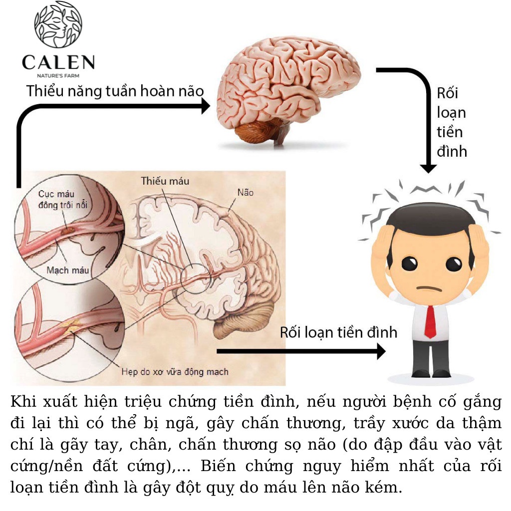 [Tiền đình hoa mắt] Trà tiền đình Calen giảm ù tai, ngất xỉu ,hoa mắt chóng mặt, suy nhược, thông hoạt khí huyết bịch 30