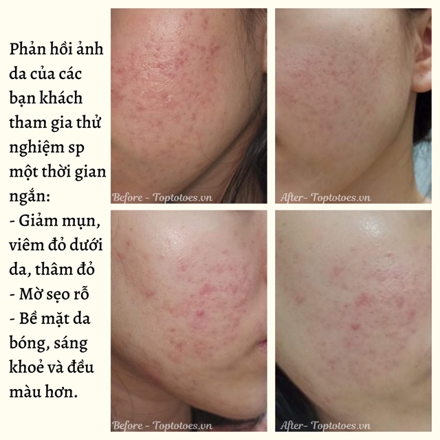 Kem dưỡng Teana Sensocalm Molecular Micro Fluid làm dịu, dưỡng ẩm, phục hồi sâu da