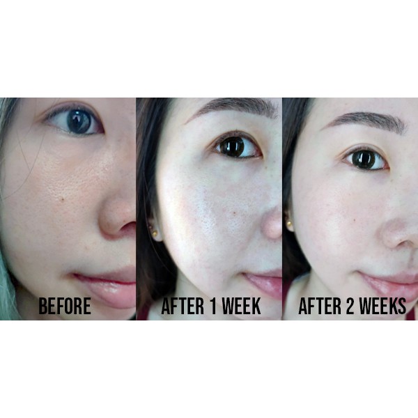 Serum tinh chất trẻ hóa da Lancome Advanced Genifique Youth Activating Concentrate