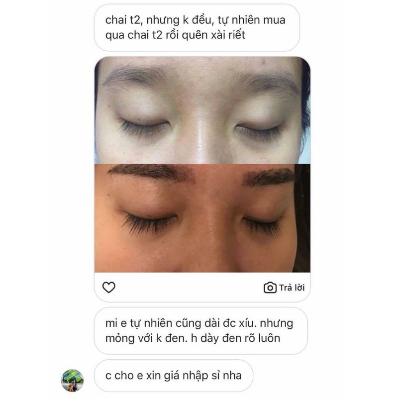 Combo Serum Dưỡng Mi FEG Toàn Diện - Mi dài,dày cong vút sau 14 ngày