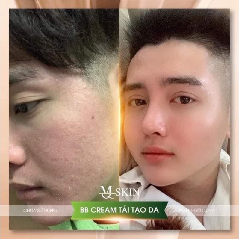 Kem Tái Tạo Da BB Cream MQ SKin
